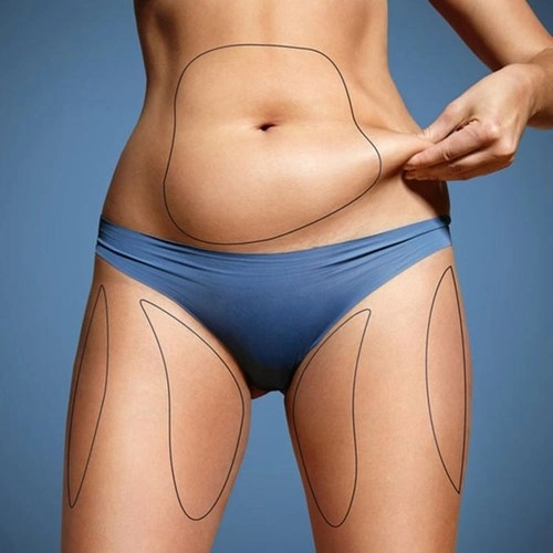 Đắp đá 30 phút mỗi ngày mỡ bụng mỡ đùi diệt hết ngay