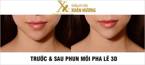 Mẹo đánh bật môi thâm môi khô nứt nẻ trong mùa đông lạnh giá