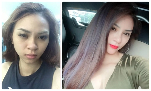Chỉ mất 1000 đồng nhận ngay suất phẫu thuật thẩm mỹ đổi đời