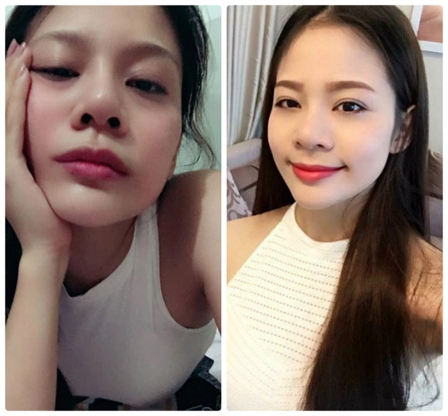 Chỉ mất 1000 đồng nhận ngay suất phẫu thuật thẩm mỹ đổi đời