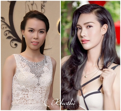 Chương trình perfect beauty được khởi động