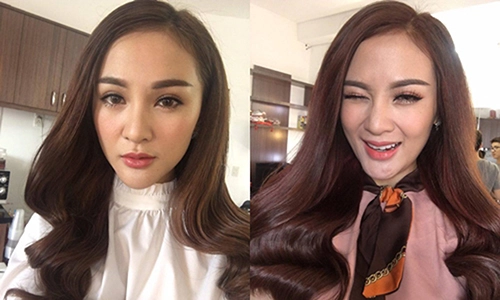 Mặt v-line và những chiếc cằm nhọn hoắt