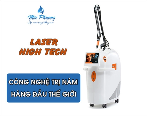 Mẹo trị nám hiệu quả bằng công nghệ laser high tech