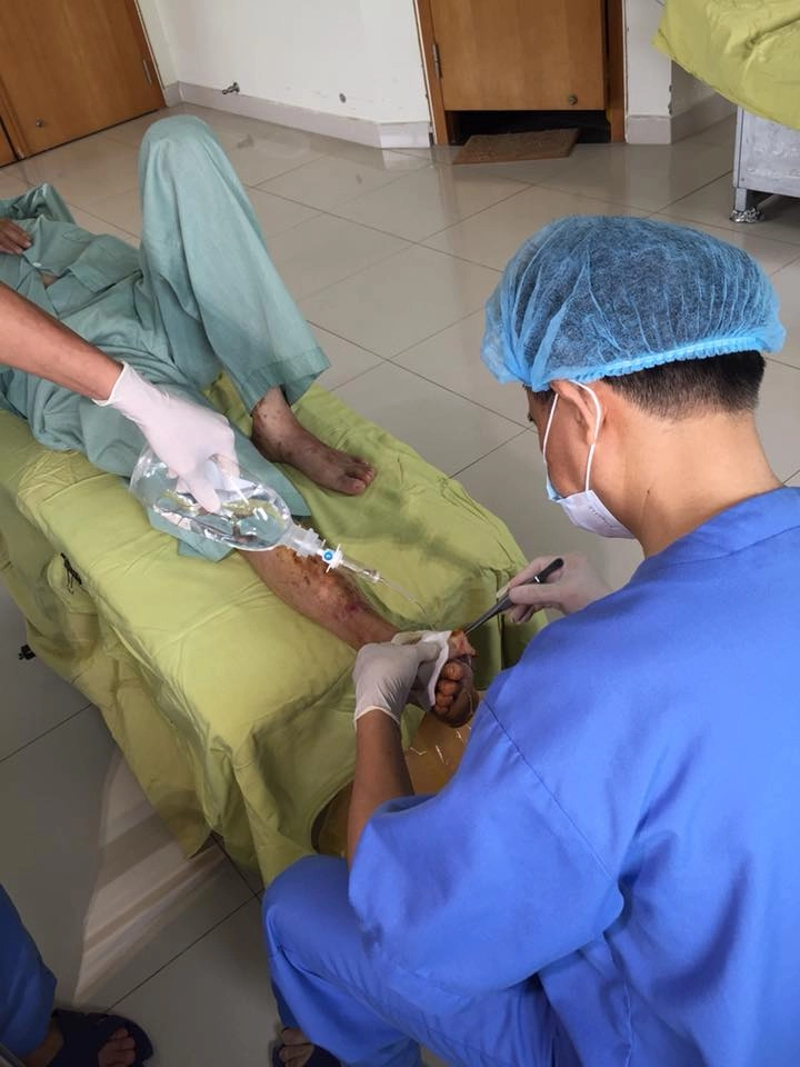 Bênh nhân co nguy cơ thao bo ban chân chi vi vai mun nươc