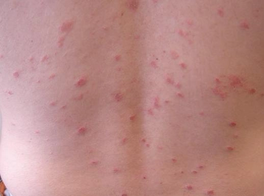 Nhưng biên chưng nguy hiêm của bênh vây nên