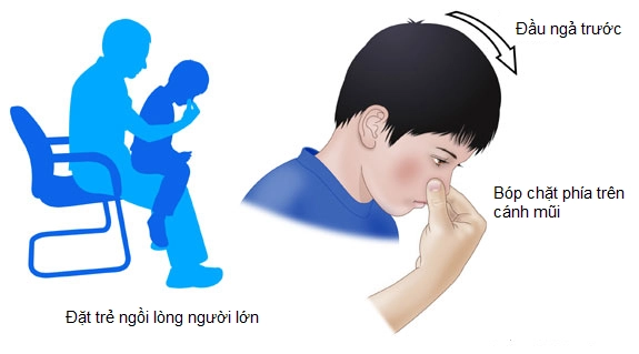 Cẩn trọng với thời tiết mùa nắng để trẻ không bị chảy máu cam