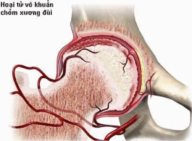 Căn bênh đang tre hoa va găp 80 ơ nam giơi nguy hiểm