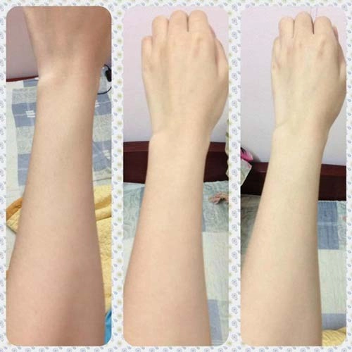 Chỉ với 1 viên b1 bạn sẽ có thần dược dưỡng trắng da