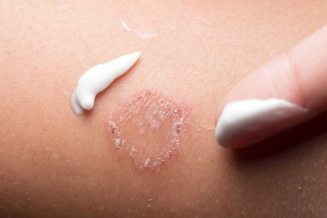 Khói hương và những ảnh hưởng đến sức khoẻ