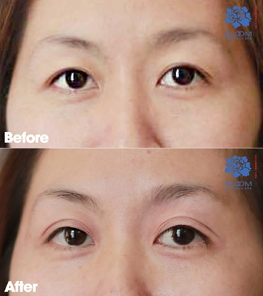 Giải pháp cho đôi mắt đẹp sau 30 phút