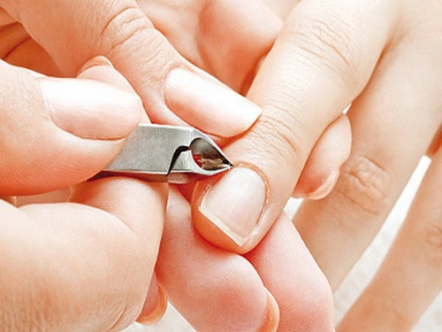 Nhập viện vì thói quen cắn xước măng-rô ngón tay