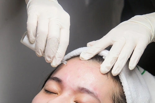 Xôn xao công nghệ trị mụn và trẻ hóa 2 trong 1