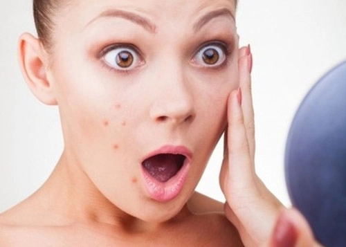 Xôn xao công nghệ trị mụn và trẻ hóa 2 trong 1