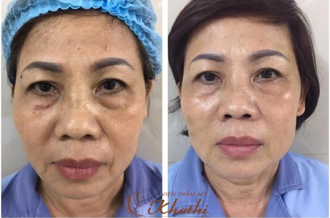 Tút tát diện mạo đón tết với giá chỉ một nửa