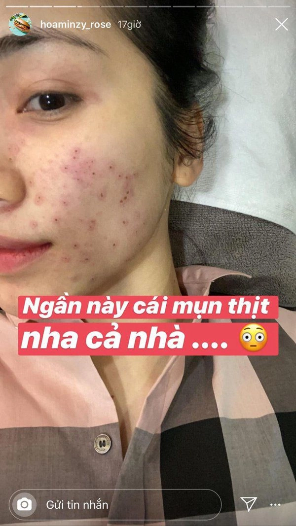 Các bước skincare để có làn da đẹp như hòa minzy