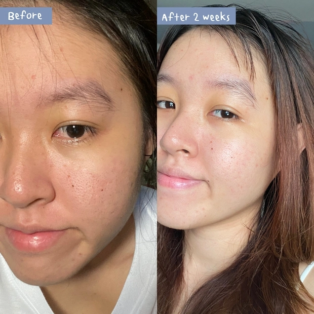 Review eucerin crystal booster serum chuyên trị thâm nám