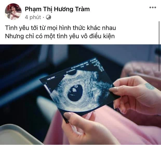 Cuộc sống hương tràm sau 4 năm sang mỹ 