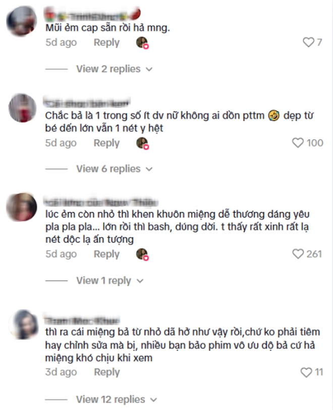 Đôi môi trái tim đẹp quá mức của nữ chính Khom Lưng gây tranh cãi, fan phải vội minh oan- Ảnh 11. Đôi môi trái tim đẹp quá mức của nữ chính khom lưng